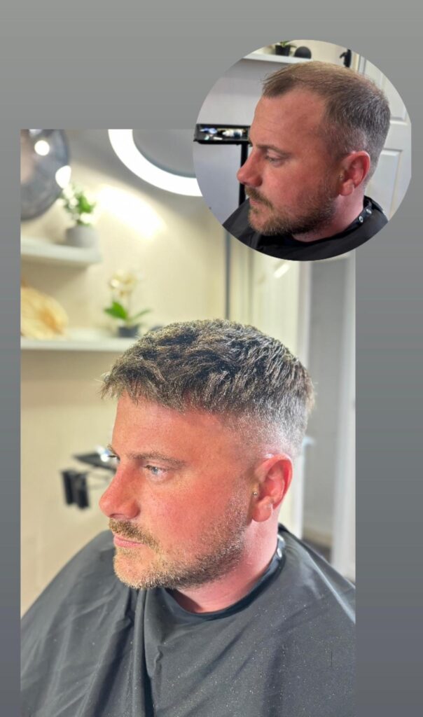 Men’s Hair Replacement System Online Course